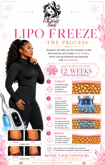 Lipo Freeze in Buffalo, NY | ExQuizit Beauty Mansion